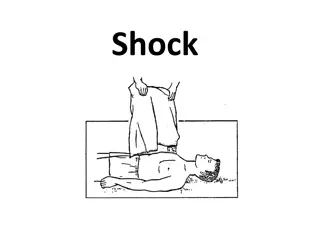 Understanding Shock: Definitions, Types, and Management Principles