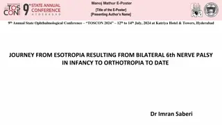 Journey from Esotropia Resulting from Bilateral 6th Nerve Palsy in Infancy to Orthotropia