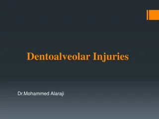 Dentoalveolar Injuries: Causes and Classification