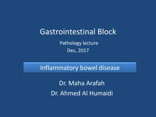 Inflammatory Bowel Disease: Crohn's Disease and Ulcerative Colitis