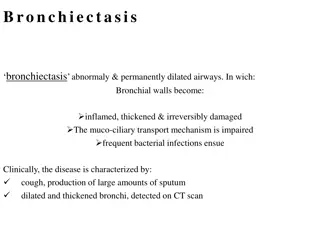 Bronchiectasis: Causes, Symptoms, and Diagnosis