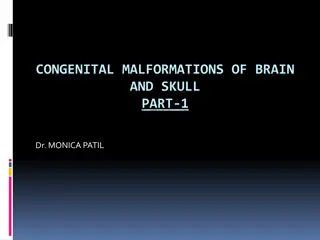 Congenital Malformations of Brain and Skull Part 1: Embryology and Neurulation