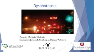 Dysphotopsia After Cataract Surgery