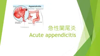 Pathophysiology of Acute Appendicitis