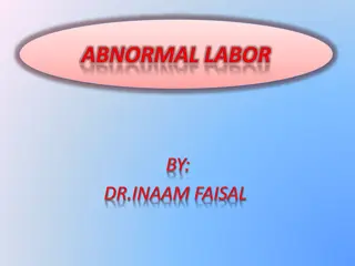 Abnormal Labor and Prolonged Labor in Childbirth