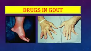 Comprehensive Guide to Gout: Pathophysiology, Treatment, and Prevention