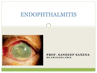 Endophthalmitis: Causes, Risks, and Management