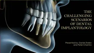 Challenging Scenarios in Dental Implantology