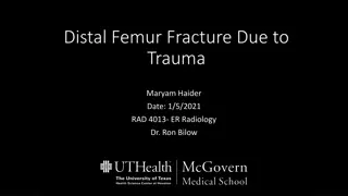 Distal Femur Fracture Diagnosis and Management Overview