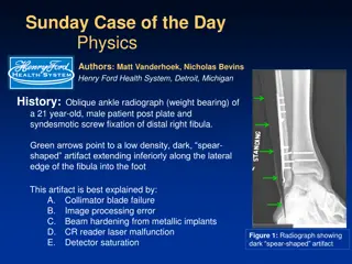 Understanding Image Processing Artifacts in Radiography