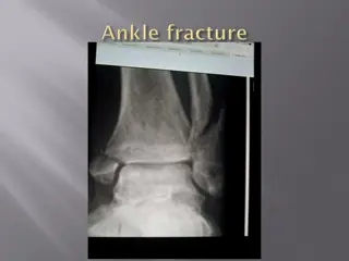 Ankle Injuries and Treatment Options