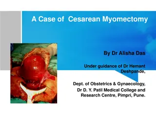 Case Study: Cesarean Myomectomy Conducted by Dr. Alisha Das