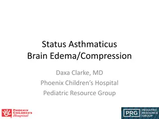 Understanding Status Asthmaticus: Diagnosis and Treatment Considerations