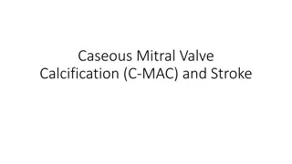 Caseous Mitral Valve Calcification (C-MAC) and Stroke: Overview and Management