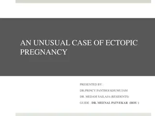 Unusual Case of Ectopic Pregnancy: A Detailed Analysis