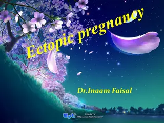 Ectopic Pregnancy: Causes, Risks, and Management