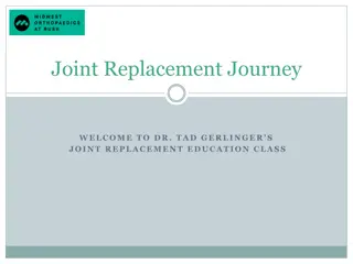 Comprehensive Guide to Knee Joint Replacement Surgery