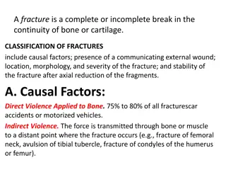 Fractures: Classification and Factors