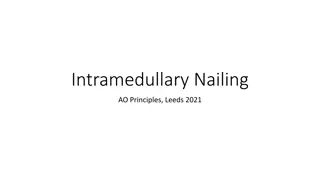 Comprehensive Guide to Reamed Intramedullary Nailing Techniques