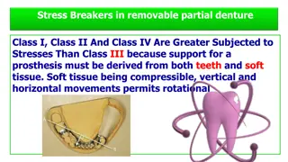 Stress Breakers in Removable Partial Dentures