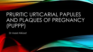 Understanding Pruritic Urticarial Papules and Plaques of Pregnancy (PUPPP)