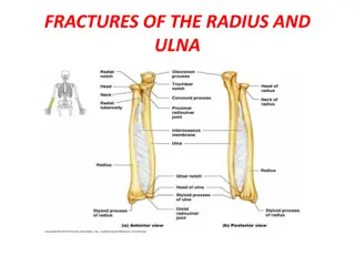 Fractures of the Radius and Ulna: Mechanism, Clinical Features, and Treatment