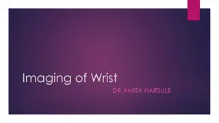 Comprehensive Imaging of Wrist by Dr. Amita Harsule