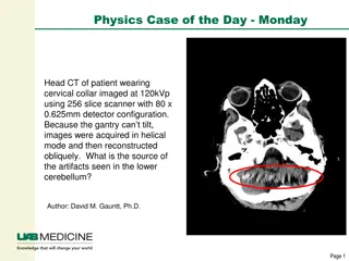 Artifact Sources in Head CT Imaging