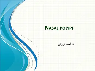 Nasal Polypi and Their Classifications