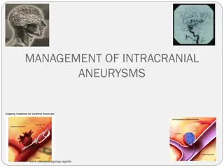 Understanding the Management of Intracranial Aneurysms