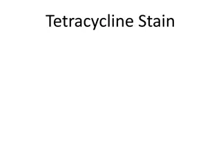 Tetracycline Stain in Teeth Development