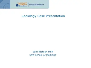 Radiology Case Presentation: Rocky Mountain Spotted Fever in a Young Female