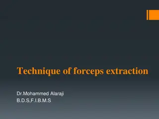 Dental Forceps Extraction Technique by Dr. Mohammed Alaraji