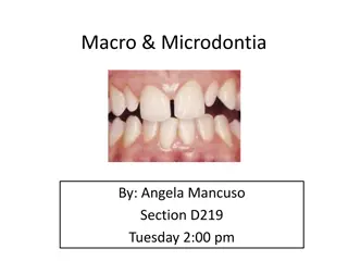 Macro and Microdontia in Dentistry