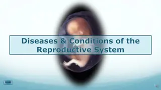 Reproductive System Diseases and Conditions Overview