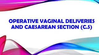 Overview of Operative Vaginal Deliveries and Caesarean Section