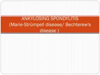 Ankylosing Spondylitis: Causes, Symptoms, and Pathogenesis