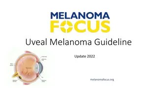 Uveal Melanoma Guideline Update 2022: Summary & Recommendations