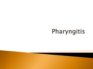 Overview of Pharyngitis: Symptoms, Causes, and Classification