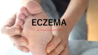 Understanding Eczema: Causes, Classifications, and Pathogenesis