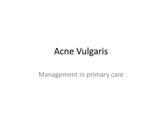 Acne Vulgaris Management in Primary Care