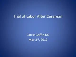 Understanding Trial of Labor After Cesarean (TOLAC) for VBAC Success