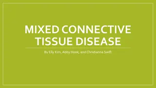 Mixed Connective Tissue Disease (MCTD)