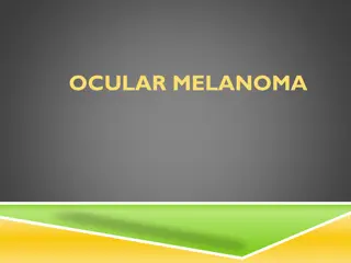 Understanding Ocular Melanoma: Symptoms, Diagnosis, and Treatment