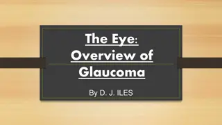 Understanding Glaucoma: Types, Symptoms, and Treatment Options