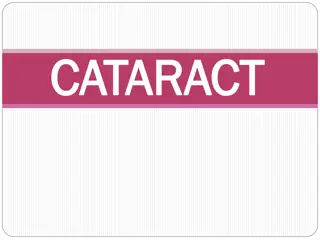 Understanding Cataracts: Types, Causes, and Classification