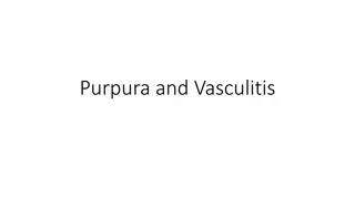 Purpura and Vasculitis: A Comprehensive Guide