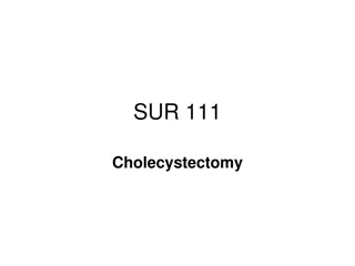 Cholecystectomy and Biliary System Anatomy