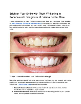 Brighten Your Smile with Teeth Whitening in Konanakunte Bengaluru at Prisma Dental Care