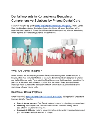 Dental Implants in Konanakunte Bengaluru_ Comprehensive Solutions by Prisma Dental Care